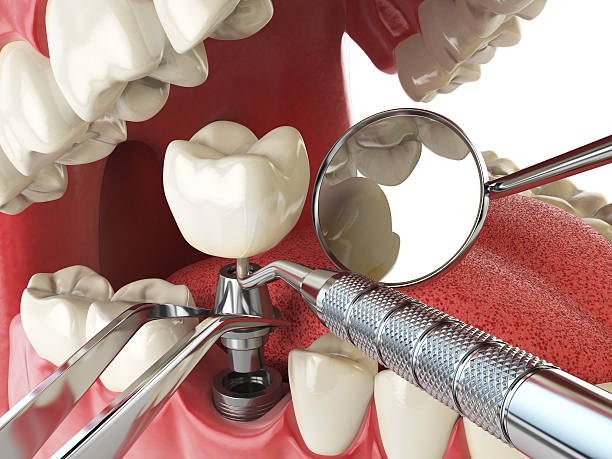 Best Emergency Dentist for Knocked-Out Tooth in La Feria, TX